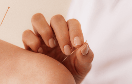L'acupuncture fonctionne-t-elle pour maigrir ?